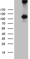 IL20RA Antibody - HEK293T cells were transfected with the pCMV6-ENTRY control. (Left lane) or pCMV6-ENTRY IL20RA. (Right lane) cDNA for 48 hrs and lysed