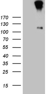 IL20RA Antibody - HEK293T cells were transfected with the pCMV6-ENTRY control. (Left lane) or pCMV6-ENTRY IL20RA. (Right lane) cDNA for 48 hrs and lysed. Equivalent amounts of cell lysates. (5 ug per lane) were separated by SDS-PAGE and immunoblotted with anti-IL20RA. (1:2000)