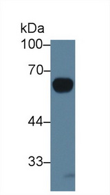 IL20RA Antibody - Western Blot; Sample: Rat Serum; Primary Ab: 3µg/ml Rabbit Anti-Rat IL20Ra Antibody Second Ab: 0.2µg/mL HRP-Linked Caprine Anti-Rabbit IgG Polyclonal Antibody