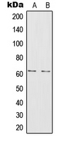 IL20RA Antibody - Western blot analysis of IL-20RA expression in A375 (A); MCF7 (B) whole cell lysates.
