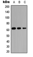 IL20RA Antibody - Western blot analysis of IL-20RA expression in MCF7 (A); NS-1 (B); PC12 (C) whole cell lysates.