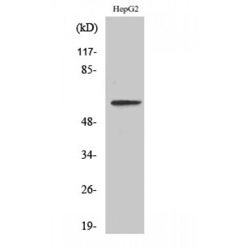 IL20RA Antibody - Western blot of IL-20Ralpha antibody