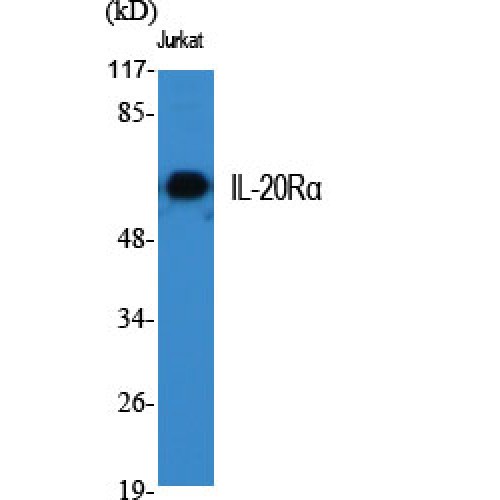 IL20RA Antibody - Western blot of IL-20Ralpha antibody