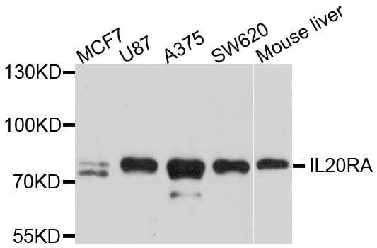 IL20RA Antibody - Western blot analysis of extracts of various cell lines, using IL20RA antibody at 1:1000 dilution. The secondary antibody used was an HRP Goat Anti-Rabbit IgG (H+L) at 1:10000 dilution. Lysates were loaded 25ug per lane and 3% nonfat dry milk in TBST was used for blocking. An ECL Kit was used for detection and the exposure time was 90s.