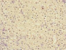 IL20RA Antibody - Immunohistochemistry of paraffin-embedded human adrenal gland tissue at dilution 1:100