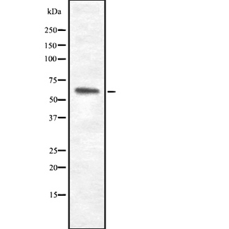 IL20RA Antibody - Western blot analysis IL-20R alpha using LOVO cells whole cells lysates