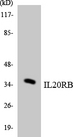 IL20RB Antibody - Western blot analysis of the lysates from COLO205 cells using IL20RB antibody.