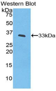 IL20RB Antibody - Western blot of recombinant IL20RB.  This image was taken for the unconjugated form of this product. Other forms have not been tested.