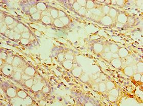 IL20RB Antibody - Immunohistochemistry of paraffin-embedded human rectum using antibody at 1:100 dilution.