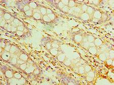 IL20RB Antibody - Immunohistochemistry of paraffin-embedded human rectum using antibody at 1:100 dilution.