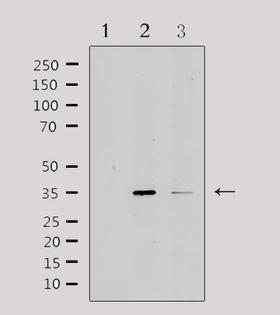 IL20RB Antibody - Western blot analysis of extracts of various samples using IL20RB antibody. Lane 1: HepG2 treated with blocking peptide; Lane 2: HepG2; Lane 3: mouse spleen;
