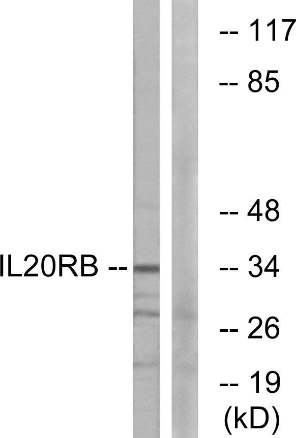 IL20RB Antibody - Western blot analysis of extracts from HeLa cells, using IL20RB antibody.