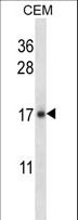 IL21 Antibody - IL21 Antibody western blot of CEM cell line lysates (35 ug/lane). The IL21 antibody detected the IL21 protein (arrow).