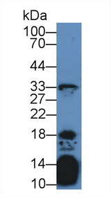 IL21 Antibody - Western Blot; Sample: Mouse Thymus lysate; Primary Ab: 2µg/mL Rabbit Anti-Human IL21 Antibody Second Ab: 0.2µg/mL HRP-Linked Caprine Anti-Rabbit IgG Polyclonal Antibody