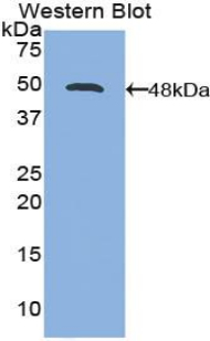 IL21 Antibody - Western blot of IL21 antibody.