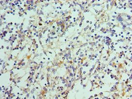 IL21 Antibody - Immunohistochemistry of paraffin-embedded human spleen using antibody at 1:100 dilution.