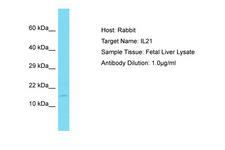 IL21 Antibody -  This image was taken for the unconjugated form of this product. Other forms have not been tested.
