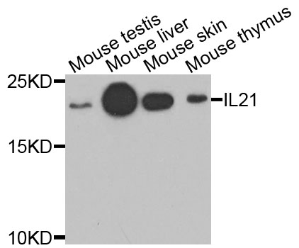 IL21 Antibody - Western blot analysis of extracts of various cells.
