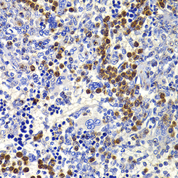 IL21 Antibody - Immunohistochemistry of paraffin-embedded rat spleen tissue.