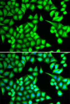 IL21 Antibody - Immunofluorescence analysis of HeLa cells.