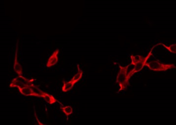IL21 Antibody - Staining HuvEc cells by IF/ICC. The samples were fixed with PFA and permeabilized in 0.1% Triton X-100, then blocked in 10% serum for 45 min at 25°C. The primary antibody was diluted at 1:200 and incubated with the sample for 1 hour at 37°C. An Alexa Fluor 594 conjugated goat anti-rabbit IgG (H+L) Ab, diluted at 1/600, was used as the secondary antibody.