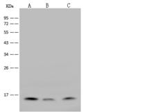IL21 Antibody - Anti-IL21 rabbit polyclonal antibody at 1:500 dilution. Lane A: HL-60 Whole Cell Lysate. Lane B: Rat spleen tissue lysate. Lane C: Rat brain tissue lysate. Lysates/proteins at 30 ug per lane. Secondary: Goat Anti-Rabbit IgG (H+L)/HRP at 1/10000 dilution. Developed using the ECL technique. Performed under reducing conditions. Predicted band size: 17 kDa. Observed band size: 16 kDa.