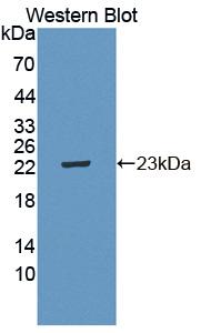 IL21 Receptor Antibody - Western blot of IL21 Receptor antibody.
