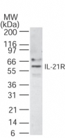 IL21 Receptor Antibody - Western blot of IL-21R in 30 ugs of Raji cell lysate using antibody at 1 ug/ml.
