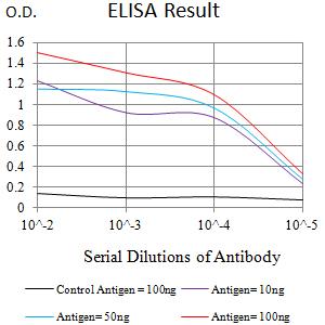 IL21 Receptor Antibody - Black line: Control Antigen (100 ng);Purple line: Antigen (10ng); Blue line: Antigen (50 ng); Red line:Antigen (100 ng)