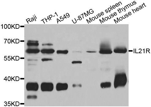 IL21 Receptor Antibody - Western blot analysis of extracts of various cell lines.