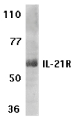 IL21 Receptor Antibody - Western blot of IL-21R expression in human Raji cell lysate with IL-21R antibody at 1 ug /ml.