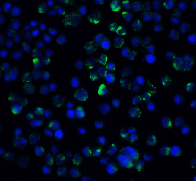 IL21 Receptor Antibody - Immunofluorescence of IL-21 Receptor in A431 cells with IL-21 Receptor antibody at 20 ug/ml.  Green: IL-21 Receptor Antibody  Blue: DAPI staining