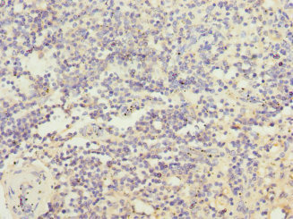 IL21 Receptor Antibody - Immunohistochemistry of paraffin-embedded human spleen tissue at dilution 1:100