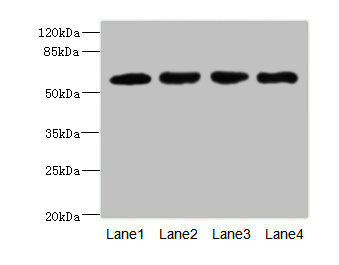 IL21 Receptor Antibody - Western blot All Lanes: IL21R antibody at 2.18ug/ml Lane 1: A549 whole cell lysate Lane 2: Raji whole cell lysate Lane 3: Colo320 whole cell lysate Lane 4: K562 whole cell lysate Secondary Goat polyclonal to Rabbit IgG at 1/10000 dilution Predicted band size: 59 kDa Observed band size: 59 kDa