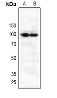 IL21 Receptor Antibody - Western blot analysis of CD360 expression in HEK293T (A), A549 (B) whole cell lysates.