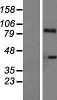 IL21 Receptor Protein - Western validation with an anti-DDK antibody * L: Control HEK293 lysate R: Over-expression lysate
