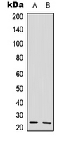 IL22 Antibody - Western blot analysis of IL-22 expression in HeLa (A); mouse kidney (B) whole cell lysates.