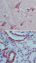 IL22 Antibody - Immunohistochemistry-Paraffin: IL22 Antibody (8F11E2) - analysis of IL-22 in human brain (top) and kidney tissue (bottom) using IL-22 antibody at 5 ug/ml.  This image was taken for the unconjugated form of this product. Other forms have not been tested.
