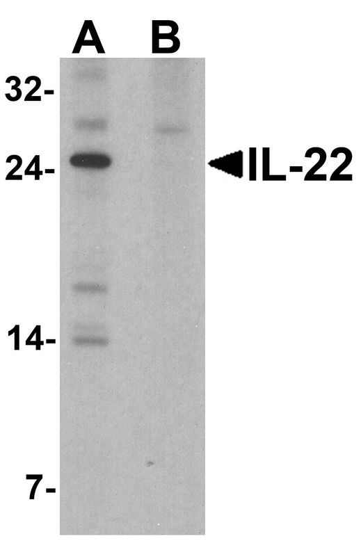 IL22 Antibody - Western blot analysis of IL-22 in HeLa cell lysate with IL-22 antibody at 1 ug/ml in (A) the absence and (B) the presence of blocking peptide.