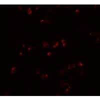 IL22 Antibody - Immunofluorescence of IL-22 in HeLa cells with IL-22 antibody at 20 µg/mL.