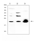 IL22 Antibody - Western blot analysis of IL-22 using anti-IL-22 antibody. Electrophoresis was performed on a 5-20% SDS-PAGE gel at 70V (Stacking gel) / 90V (Resolving gel) for 2-3 hours. The sample well of each lane was loaded with 50ug of sample under reducing conditions. Lane 1: human HepG2 whole cell lysate,Lane 2: mouse HEPA1-6 whole cell lysate,Lane 3: rat PC-12 whole cell lysate, After Electrophoresis, proteins were transferred to a Nitrocellulose membrane at 150mA for 50-90 minutes. Blocked the membrane with 5% Non-fat Milk/ TBS for 1.5 hour at RT. The membrane was incubated with rabbit anti-IL-22 antigen affinity purified polyclonal antibody at 0.5 µg/mL overnight at 4°C, then washed with TBS-0.1% Tween 3 times with 5 minutes each and probed with a goat anti-rabbit IgG-HRP secondary antibody at a dilution of 1:10000 for 1.5 hour at RT. The signal is developed using an Enhanced Chemiluminescent detection (ECL) kit with Tanon 5200 system. A specific band was detected for IL-22 at approximately 22KD. The expected band size for IL-22 is at 20KD.