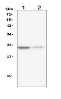 IL22 Antibody - Western blot analysis of IL22 using anti-IL22 antibody. Electrophoresis was performed on a 5-20% SDS-PAGE gel at 70V (Stacking gel) / 90V (Resolving gel) for 2-3 hours. The sample well of each lane was loaded with 50ug of sample under reducing conditions. Lane 1: human U-87MG whole cell lysates, Lane 2: human A375 whole cell lysates, After Electrophoresis, proteins were transferred to a Nitrocellulose membrane at 150mA for 50-90 minutes. Blocked the membrane with 5% Non-fat Milk/ TBS for 1.5 hour at RT. The membrane was incubated with mouse anti-IL22 antigen affinity purified monoclonal antibody at 0.5 µg/mL overnight at 4°C, then washed with TBS-0.1% Tween 3 times with 5 minutes each and probed with a goat anti-mouse IgG-HRP secondary antibody at a dilution of 1:10000 for 1.5 hour at RT. The signal is developed using an Enhanced Chemiluminescent detection (ECL) kit with Tanon 5200 system. A specific band was detected for IL22 at approximately 24KD. The expected band size for IL22 is at 20KD.