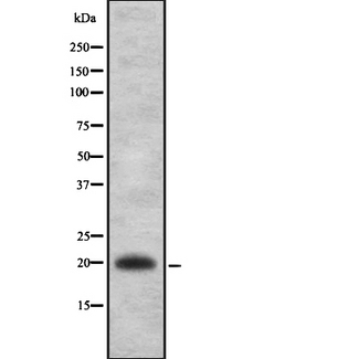 IL22 Antibody - Western blot analysis IL22 using A549 whole cells lysates