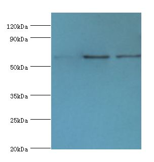 IL22RA1 / IL22R Antibody - Western blot. All lanes: IL22RA1 antibody at 10 ug/ml. Lane 1: mouse spleen tissue. Lane 2: HepG2 whole cell lysate. Lane 3: 293T whole cell lysate. secondary Goat polyclonal to rabbit at 1:10000 dilution. Predicted band size: 63 kDa. Observed band size: 63 kDa.