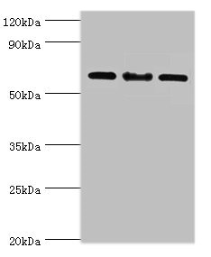 IL22RA1 / IL22R Antibody - Western blot All lanes: IL22RA1 antibody at 10µg/ml Lane 1: Mouse spleen tissue Lane 2: HepG2 whole cell lysate Lane 3: 293T whole cell lysate Secondary Goat polyclonal to rabbit IgG at 1/10000 dilution Predicted band size: 63 kDa Observed band size: 63 kDa