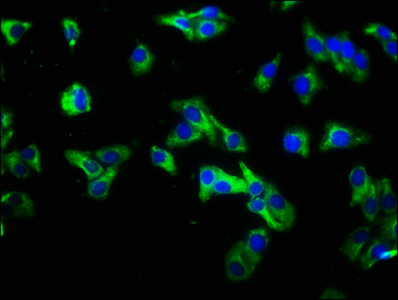 IL22RA1 / IL22R Antibody - Immunofluorescence staining of HepG2 cells with IL22RA1 Antibody at 1:333, counter-stained with DAPI. The cells were fixed in 4% formaldehyde, permeabilized using 0.2% Triton X-100 and blocked in 10% normal Goat Serum. The cells were then incubated with the antibody overnight at 4°C. The secondary antibody was Alexa Fluor 488-congugated AffiniPure Goat Anti-Rabbit IgG(H+L).