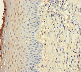 IL22RA1 / IL22R Antibody - Immunohistochemistry of paraffin-embedded human tonsil tissue using IL22RA1 Antibody at dilution of 1:100