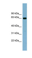 IL22RA1 / IL22R Antibody - IL22RA1 / IL22R antibody Western blot of Fetal Kidney lysate. This image was taken for the unconjugated form of this product. Other forms have not been tested.