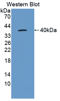 IL22RA1 / IL22R Antibody - Western blot of IL22RA1 / IL22R antibody.