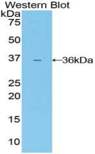 IL22RA1 / IL22R Antibody - Western blot of recombinant IL22RA1 / IL22R.  This image was taken for the unconjugated form of this product. Other forms have not been tested.